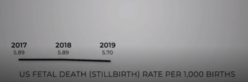 STILLBIRTHS  2017-2019